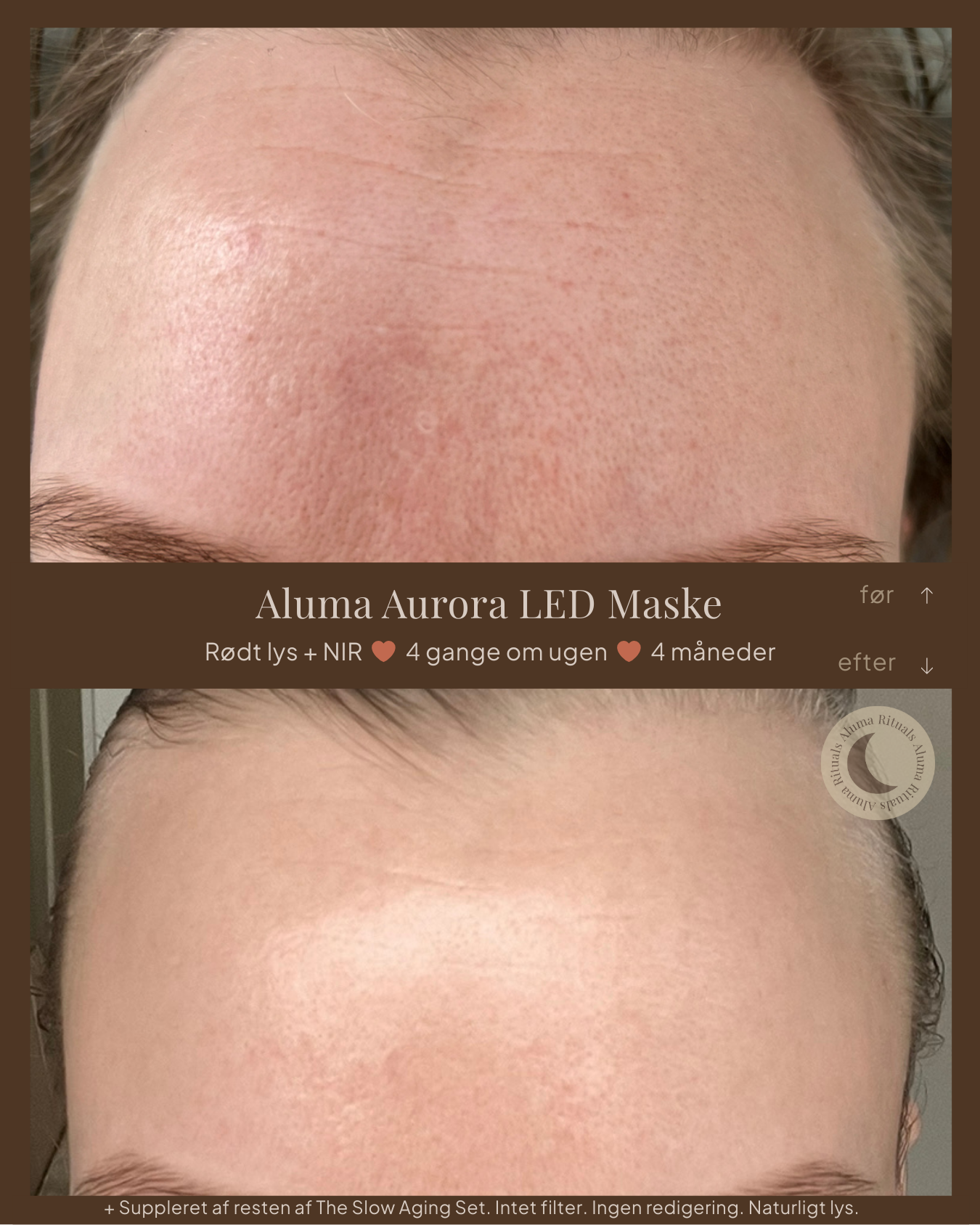 Aurora Advanced LED Light Therapy Mask